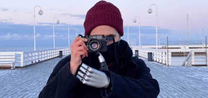 Zeus – pionierska proteza bioniczna laureatem konkursu Instytutu Lema